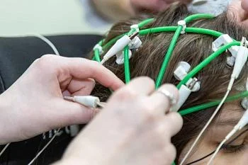 В Городской детской поликлинике широко применяются возможности новых электроэнцефалографов В Городской детской поликлинике широко применяются возможности новых электроэнцефалографов